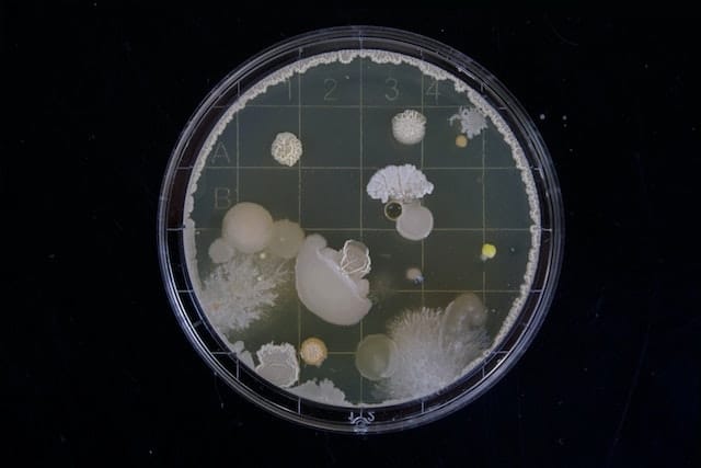 Bacteria on a Petri dish